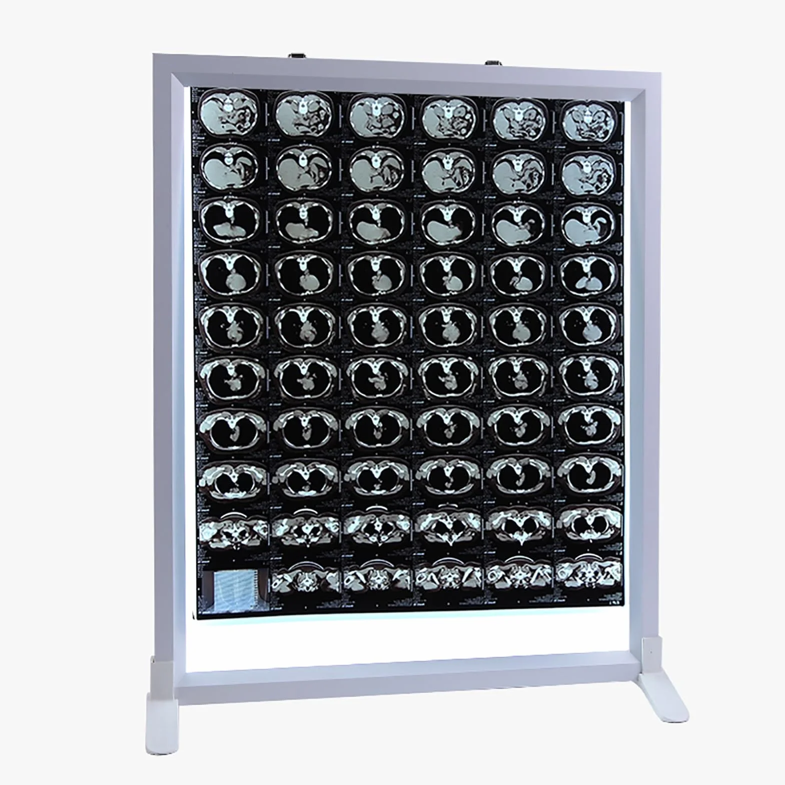 Lampada per Visione di Raggi X Pannello Luminoso per Pellicole Radiografiche 41x51cm Regolabile Medico Odontoiatrico