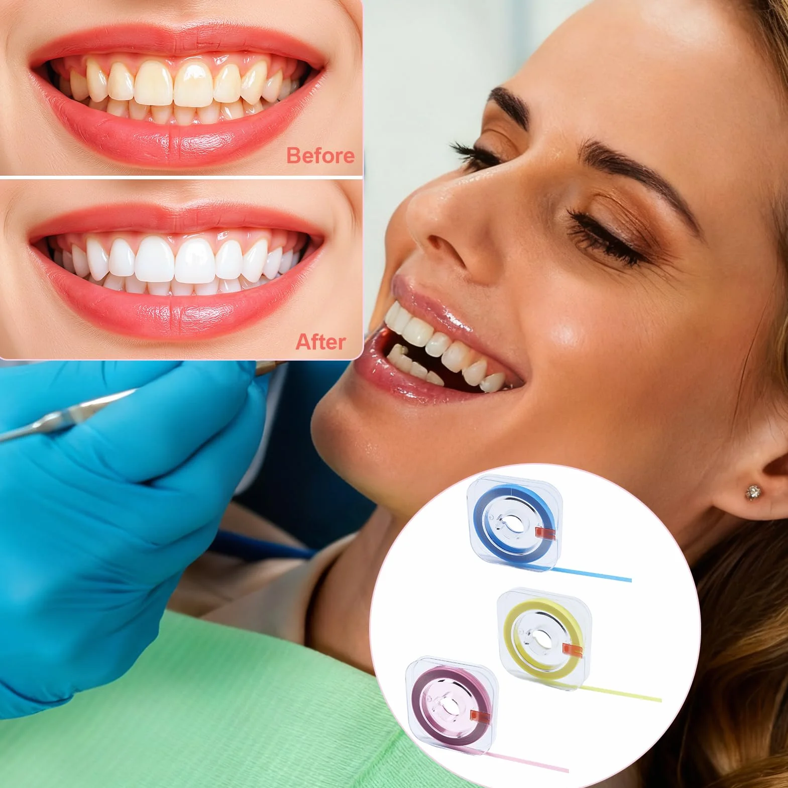 Strisce sbiancanti denti 3 Pezzi, Carta abrasiva dentale in resina