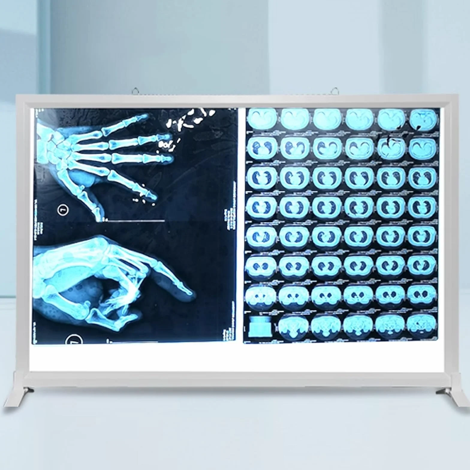 Illuminatore Pellicole Radiografiche X-ray Film Light Box 24V 41x51cm Telaio Alluminio Acrilico
