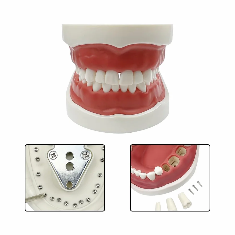 Dentale Typodont Model 28 Zębów Staccabile Strumenti Studio Didattico Articolato Anatomia Denti Rimovibili con Cacciavite