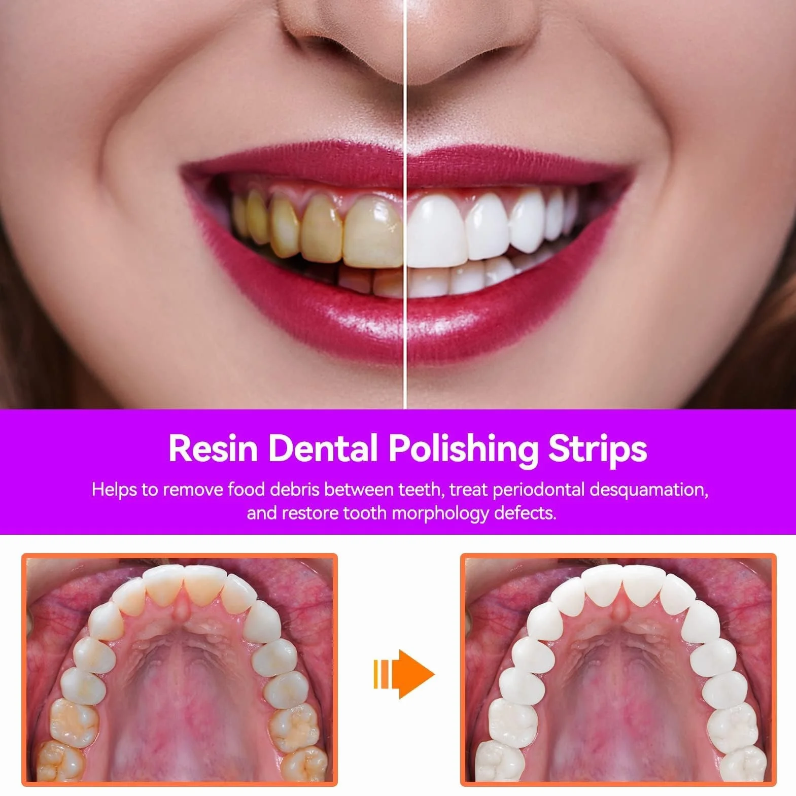 Strisce Di Lucidatura Dentale Spessore 50um Carta Abrasiva Interdentale Strumento Pulizia Profonda Igiene Orale