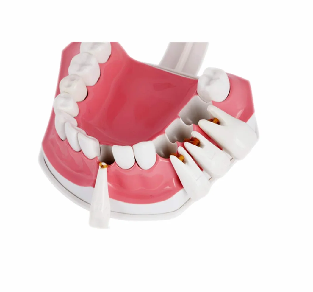 Youya Modello Dentale Grandi Dimensioni Strumento Insegnamento Dentale Spazzolino Denti Inferiori Rimovibili