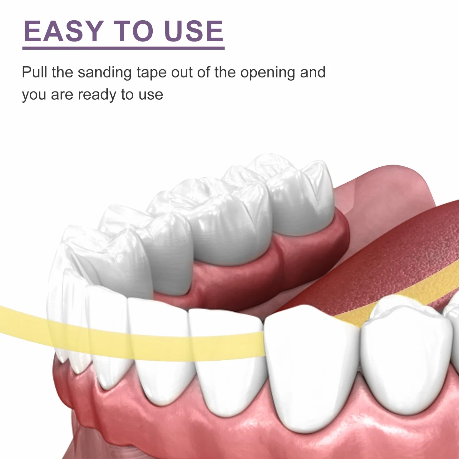 Strisce per Lucidatura Dentale 3pz Kit Abrasivo Strumento Levigatura Denti