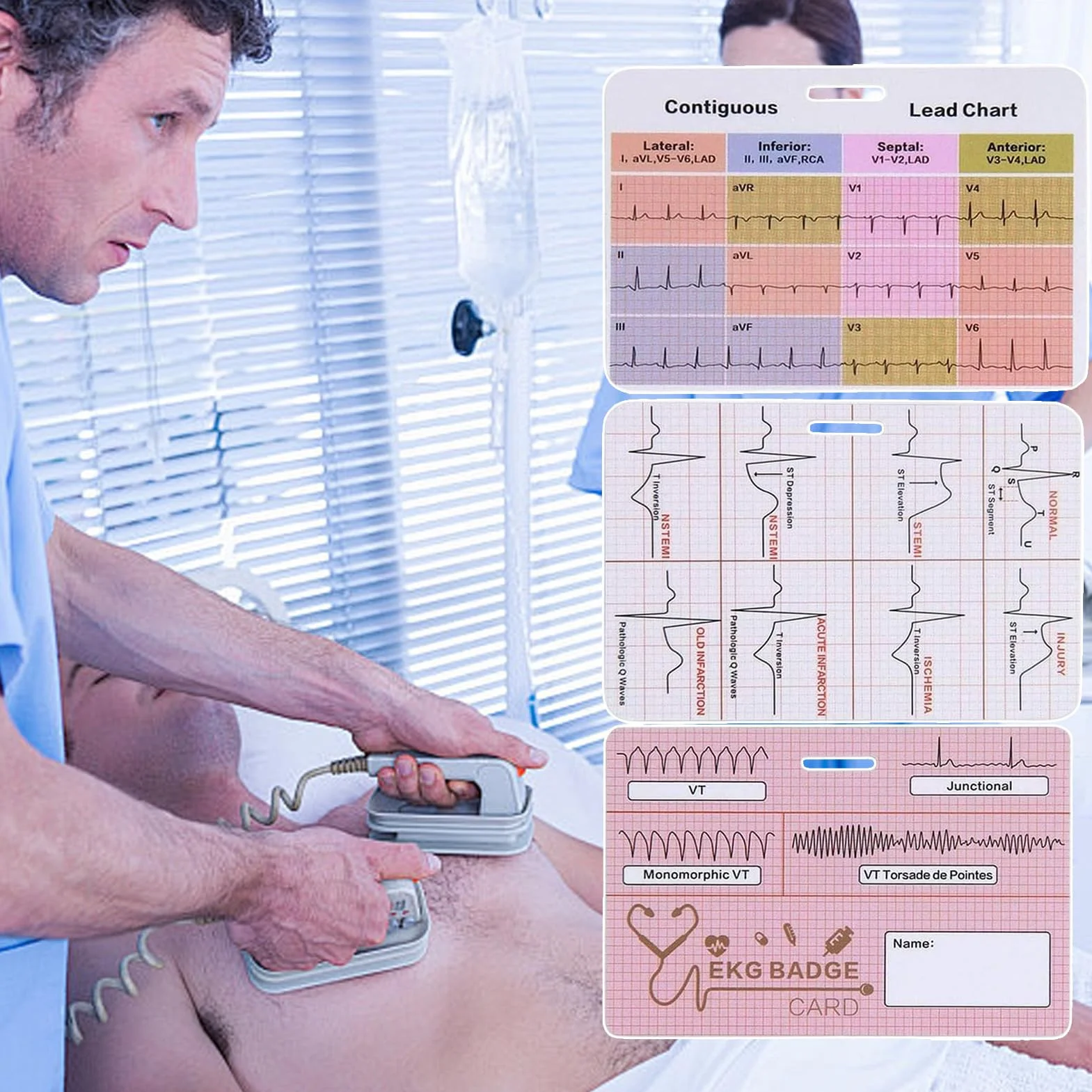 Riferimento badge ECG - Flashcard infermieristica, tre pezzi ECG, guida al ritmo cardiaco, tabella di informazioni rapide cliniche, strumento di valore del laboratorio medico | Scheda di