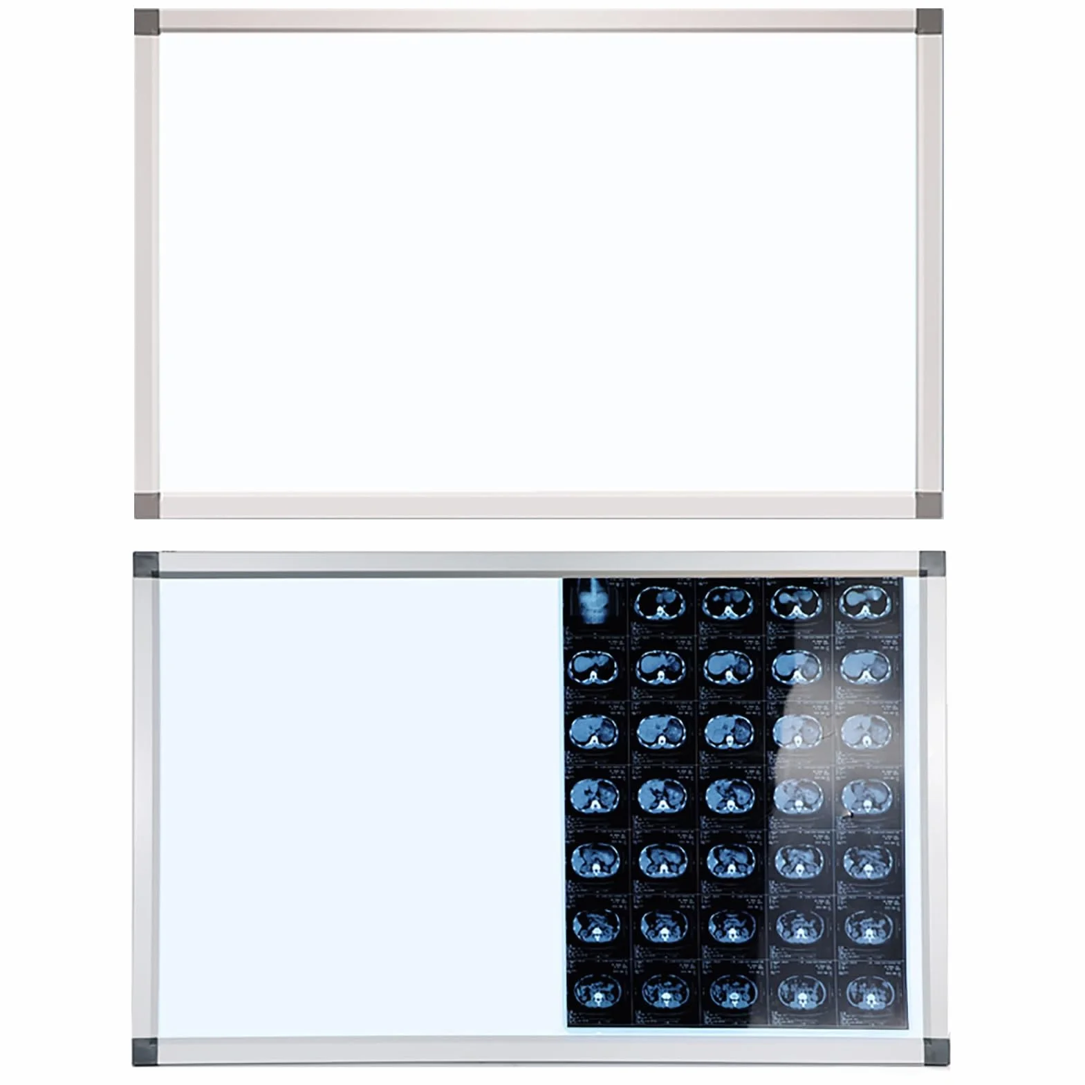 Lampada a LED per Pellicole Radiografiche Visore Medico 41x47.5cm 16x19in