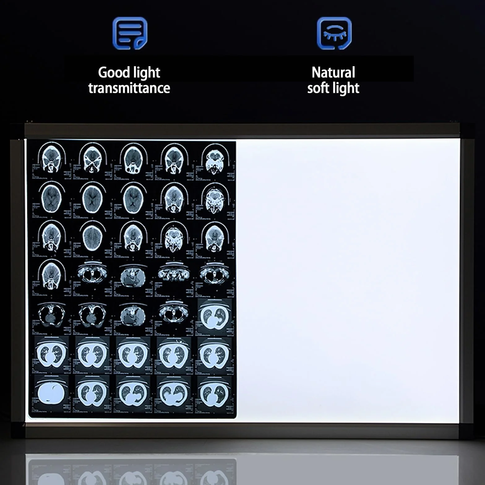 Negativoscopio a LED Scatola di visualizzazione medica a luminosità regolabile 77x47cm per pellicole radiografiche