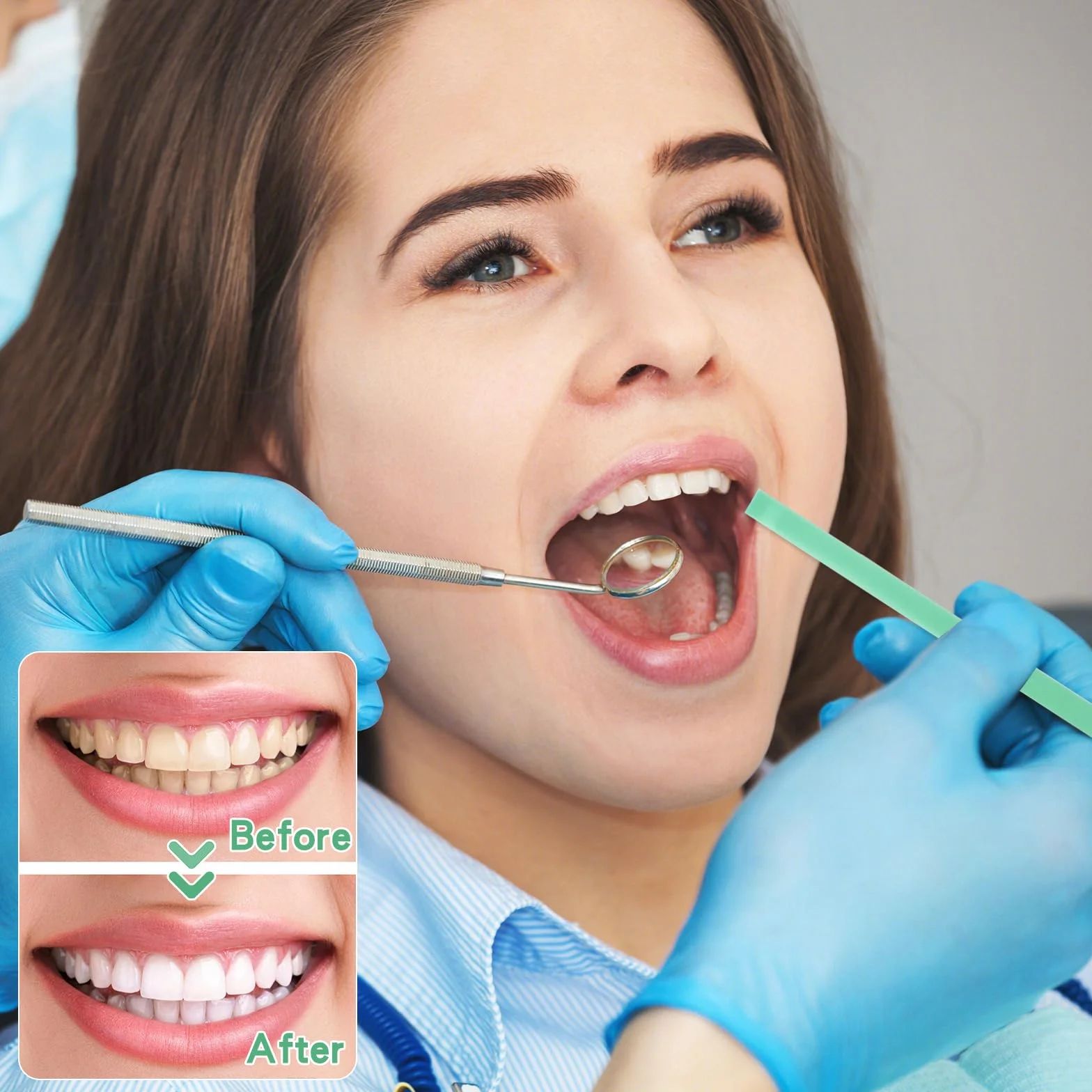 Zimoer Carta vetrata dentale 3 nastri lucidatura grana 20/30/50μm 4 mm x 6 m/rotolo