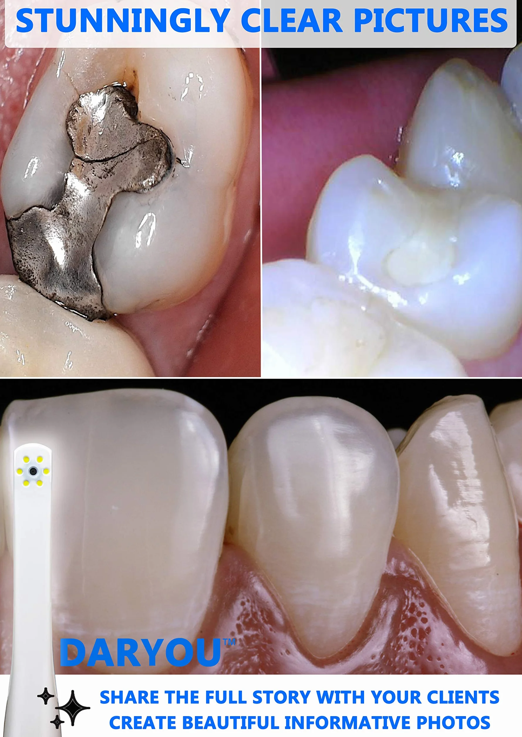 DY-50 - Fotocamera intraorale per fotocamera dentale. Il pulsante funziona davvero in Examine Pro, Logosw, DBSwin, Vixwin, Eaglesoft Dexis More.1 anno di garanzia di sostituzione