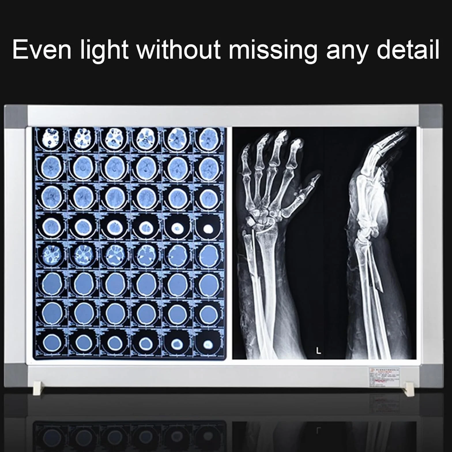 Negativoscopio a LED scatola luminosa a LED montaggio a parete luminosità regolabile pannello in acrilico telaio alluminio base supporto uso medico odontoiatrico 41x47cm