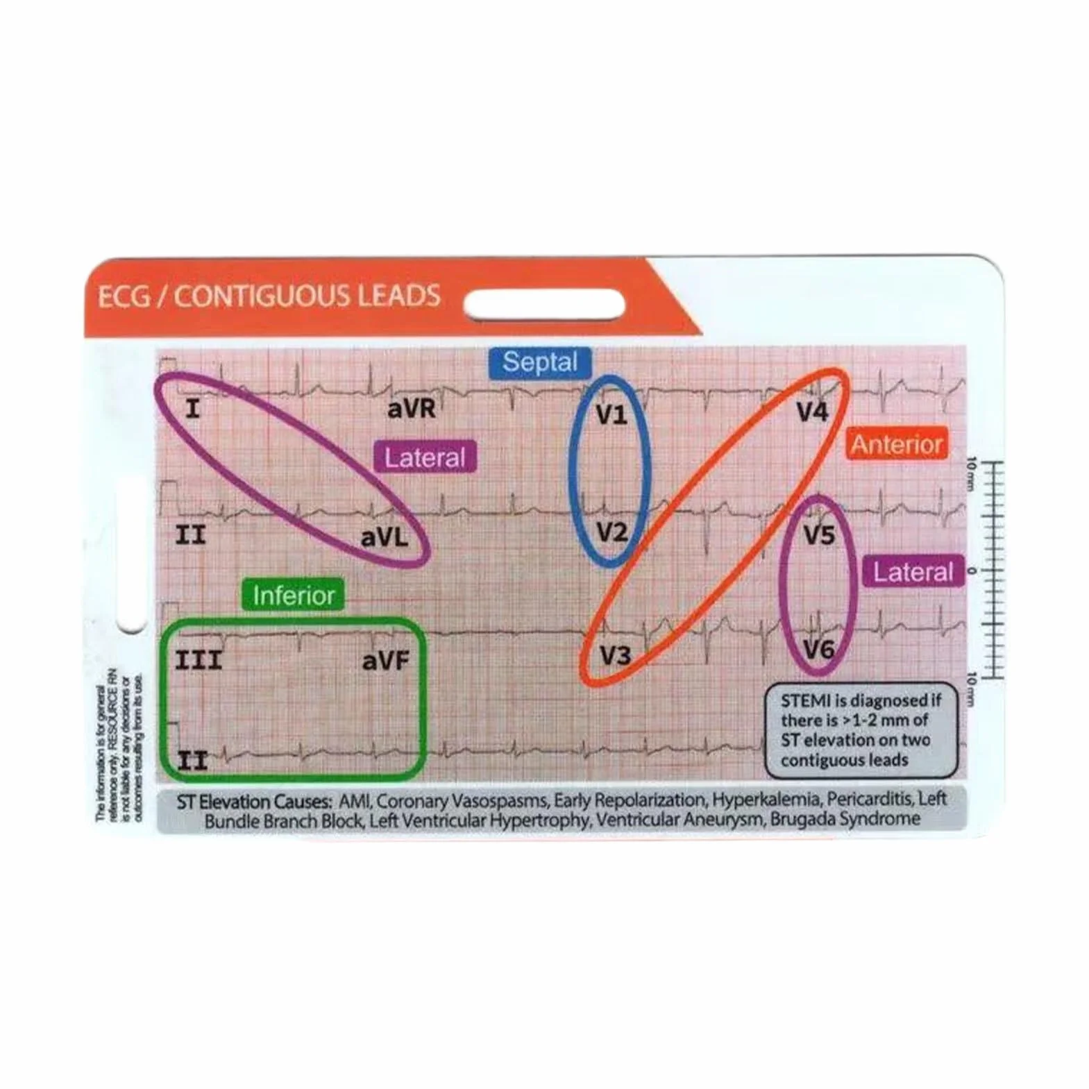 Scheda Tascabile ECG bifacciale Portatile e Durevole Sottile e Leggero. La consultazione Rapida è in Acrilico Trasparente e Semplice, B
