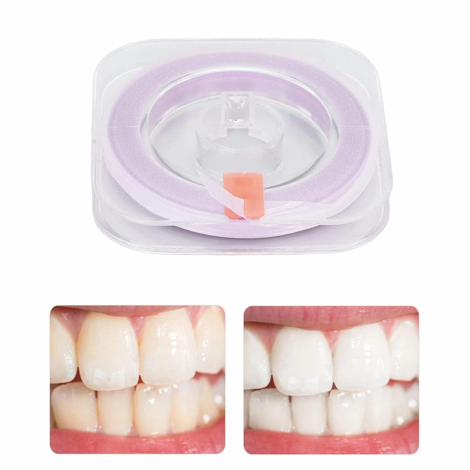 Strisce Di Lucidatura Dentale Spessore 50um Carta Abrasiva Interdentale Strumento Pulizia Profonda Igiene Orale