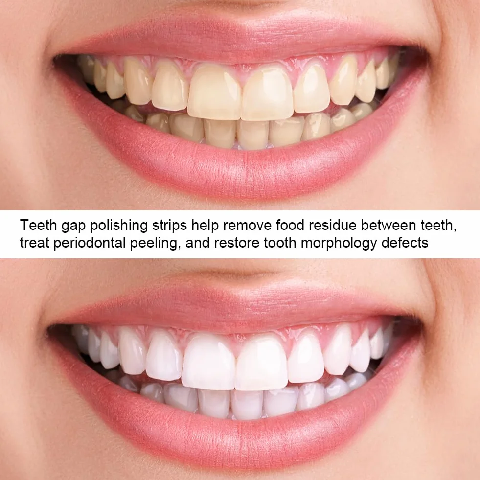 Carta vetrata dentale 3 pezzi striscia lucidatura rimozione tartaro