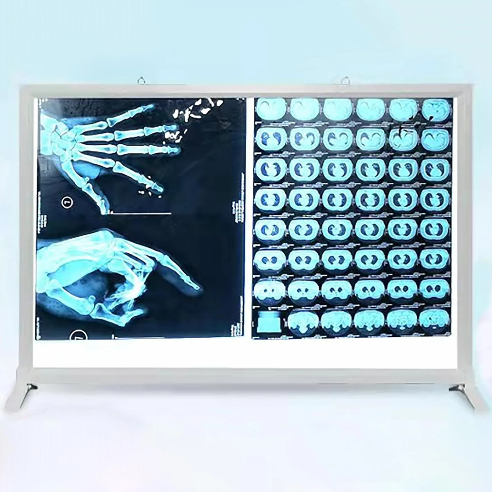 Lampada per Visione di Raggi X Pannello Luminoso per Pellicole Radiografiche 41x51cm Regolabile Medico Odontoiatrico