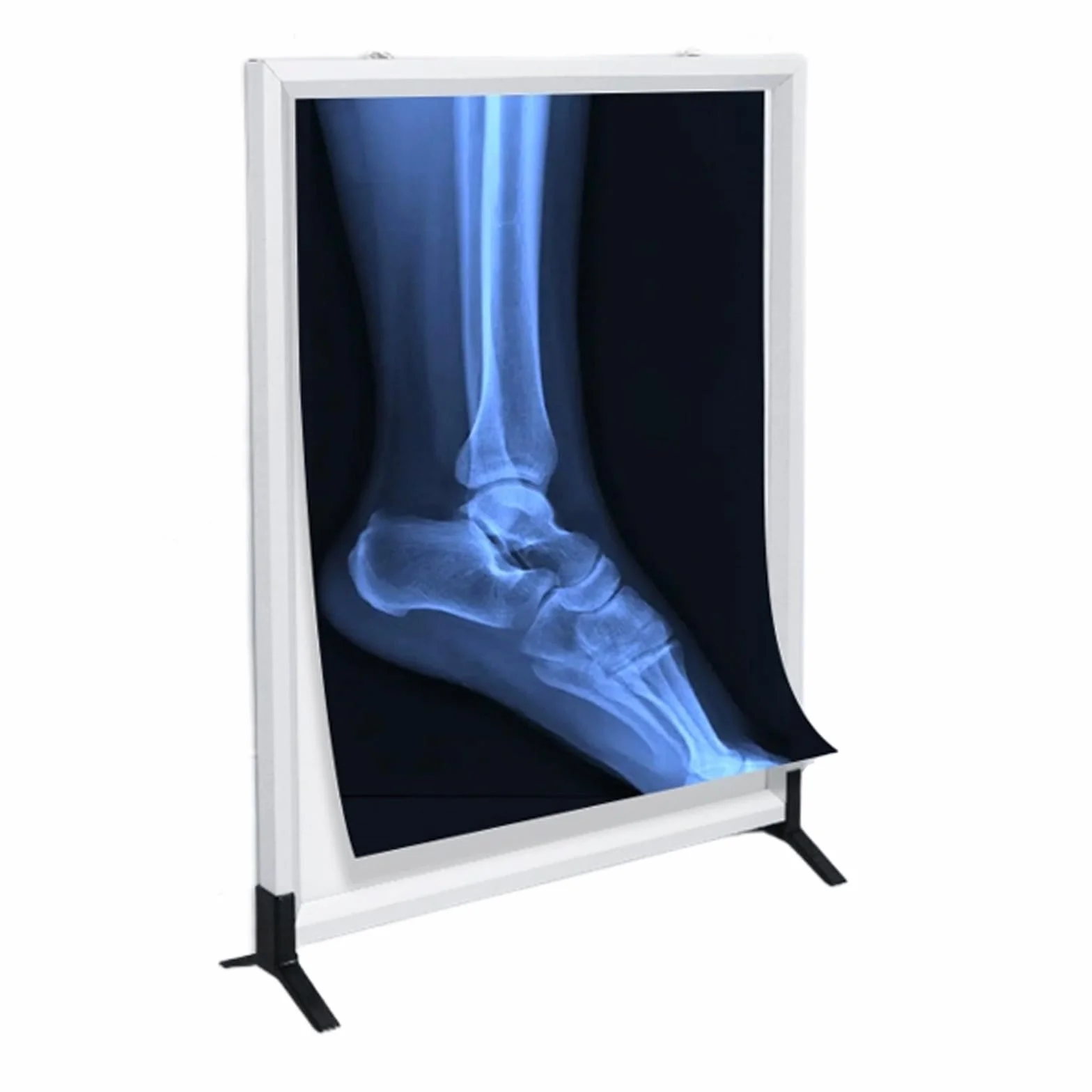 Negativoscopio Ultrapiatto a LED Pannello Scatola Luminosa for Pellicole Radiografiche a Parete