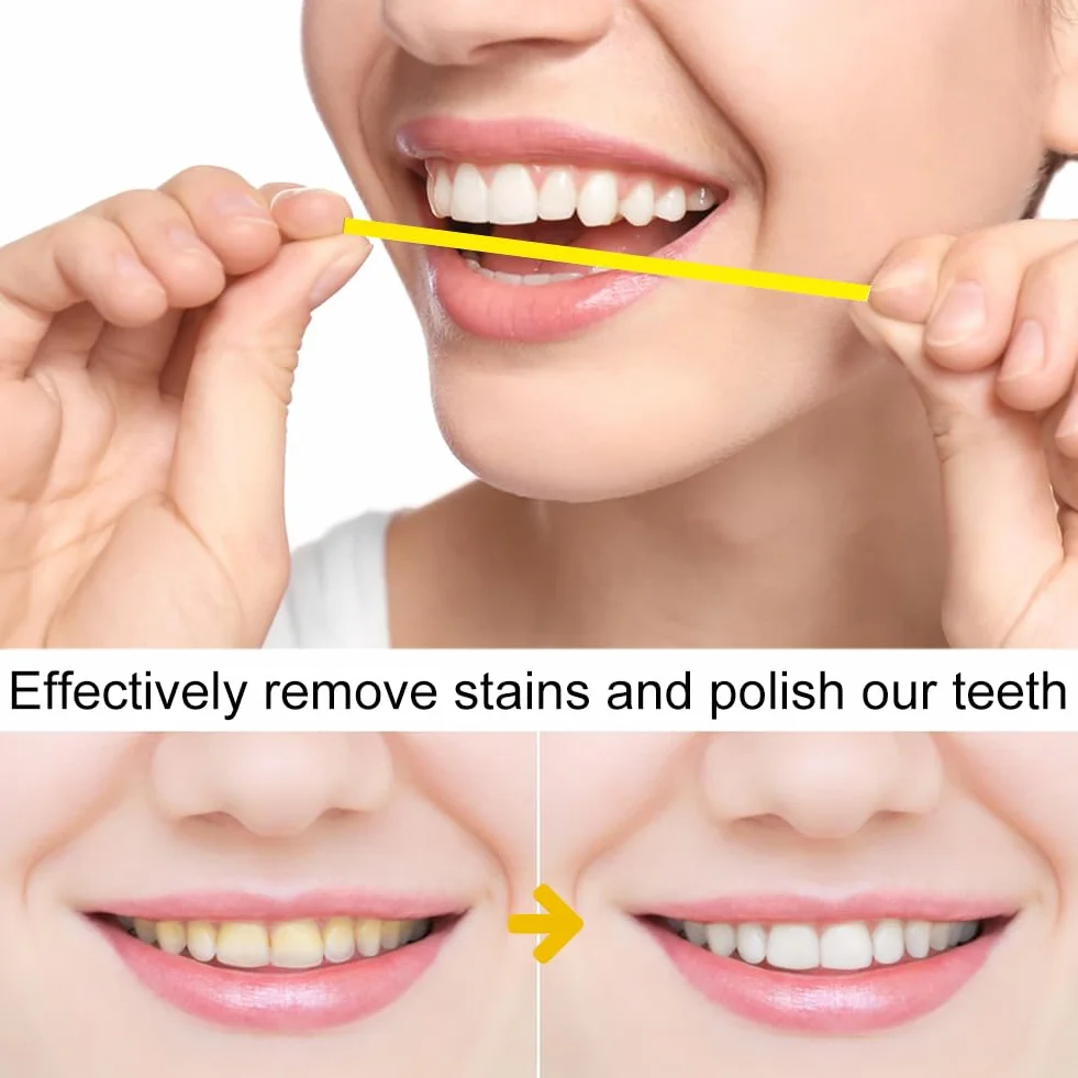 Strisce Abrasive Interdentali 20μm per Lucidatura Dentale, Pulizia e Sbiancamento