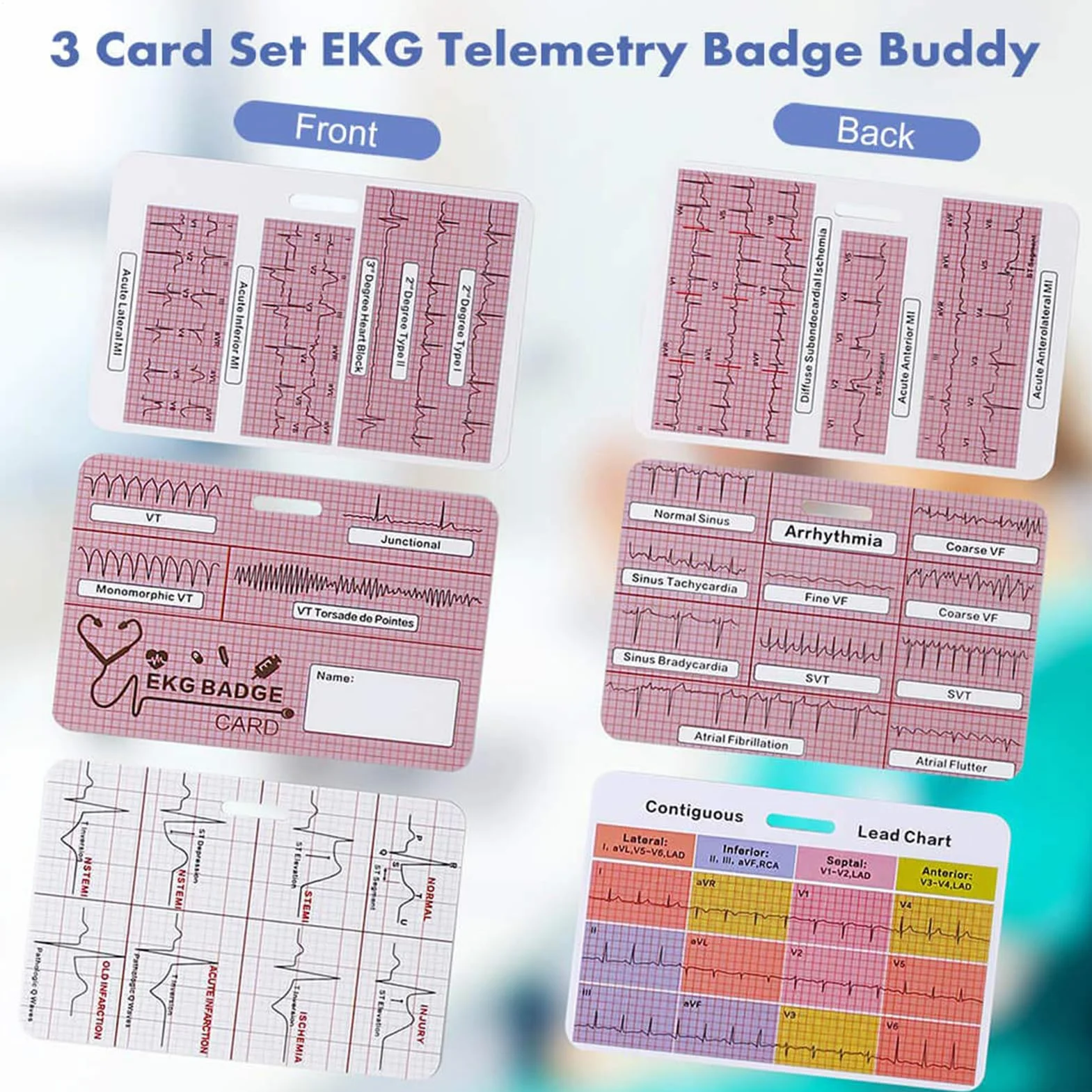 Riferimento badge ECG - Flashcard infermieristica, tre pezzi ECG, guida al ritmo cardiaco, tabella di informazioni rapide cliniche, strumento di valore del laboratorio medico | Scheda di
