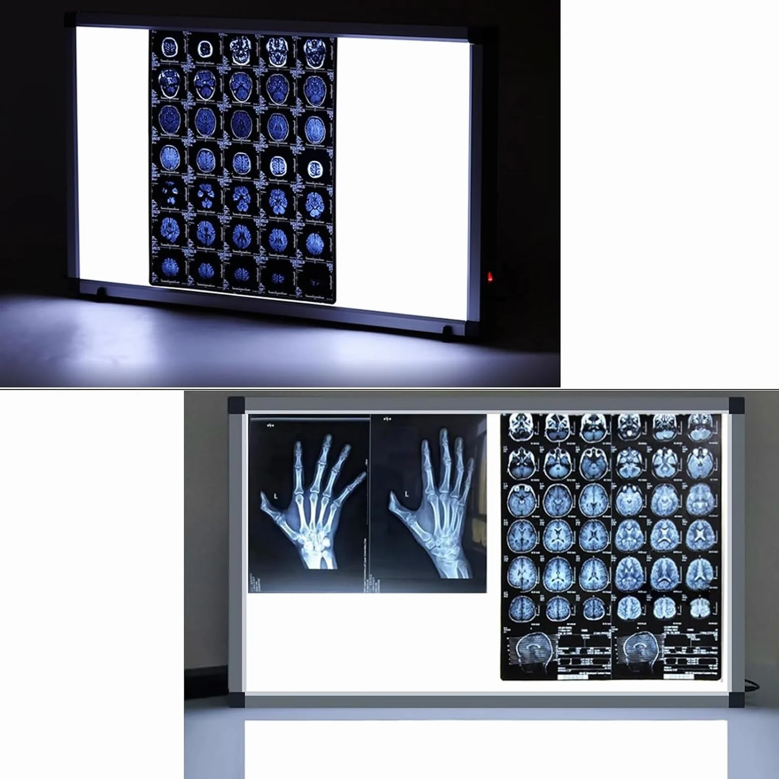 Negativoscopio a LED Scatola di visualizzazione medica a luminosità regolabile 77x47cm per pellicole radiografiche