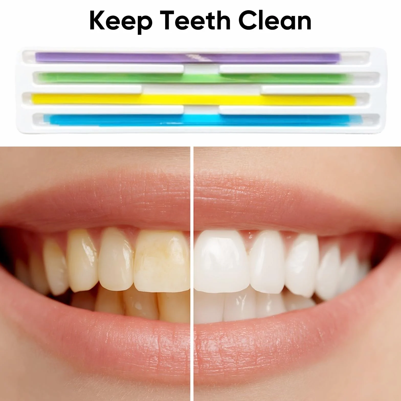 Lima dentale per denti scheggiati 60 pezzi strisce abrasive dentali smerigliatura levigatura pre-lucidatura