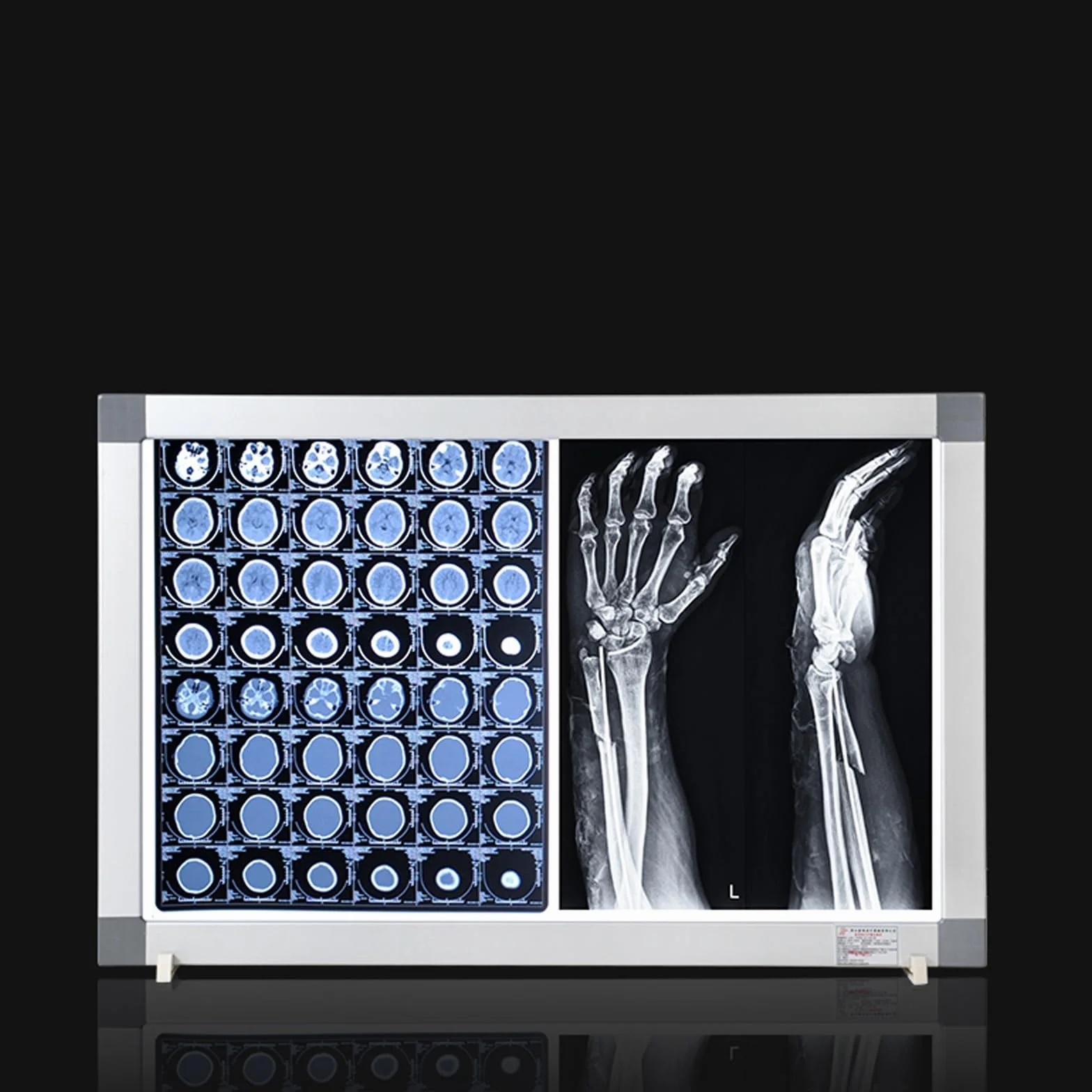 Illuminatore per Pellicole a Raggi X Led Schermo Radiografico Ultrasottile 6,5 cm Staffa Cliniche Ospedaliere 40x47x6,5cm