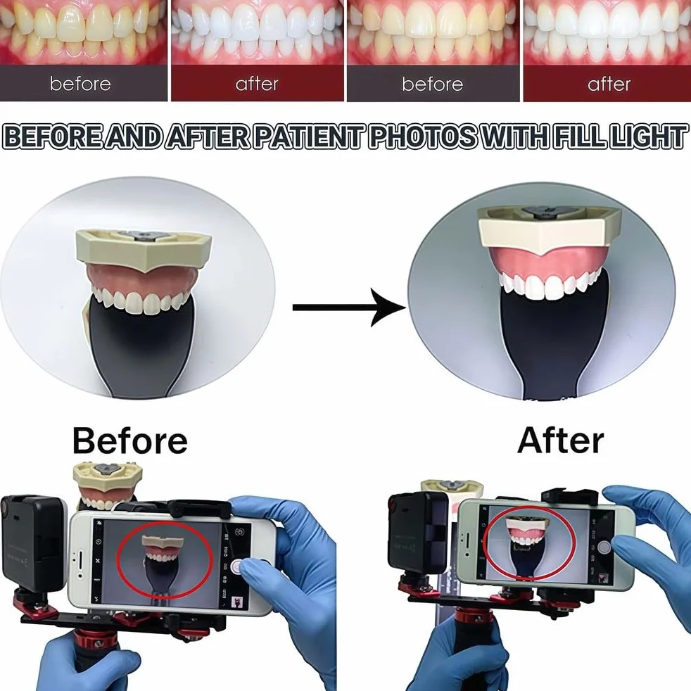 Dental Photography Aid - Supplemento luminoso di riempimento per fotocamere cellulari, ideale per cosmetologia e fotografia macro di prodotti