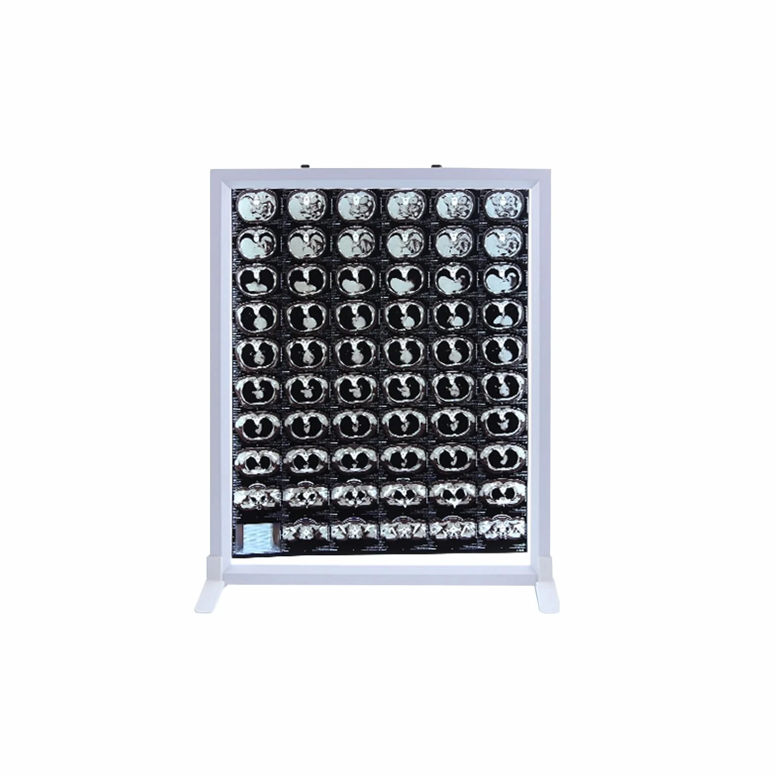 Illuminatore Pellicole Radiografiche X-ray Film Light Box 24V 41x51cm Telaio Alluminio Acrilico