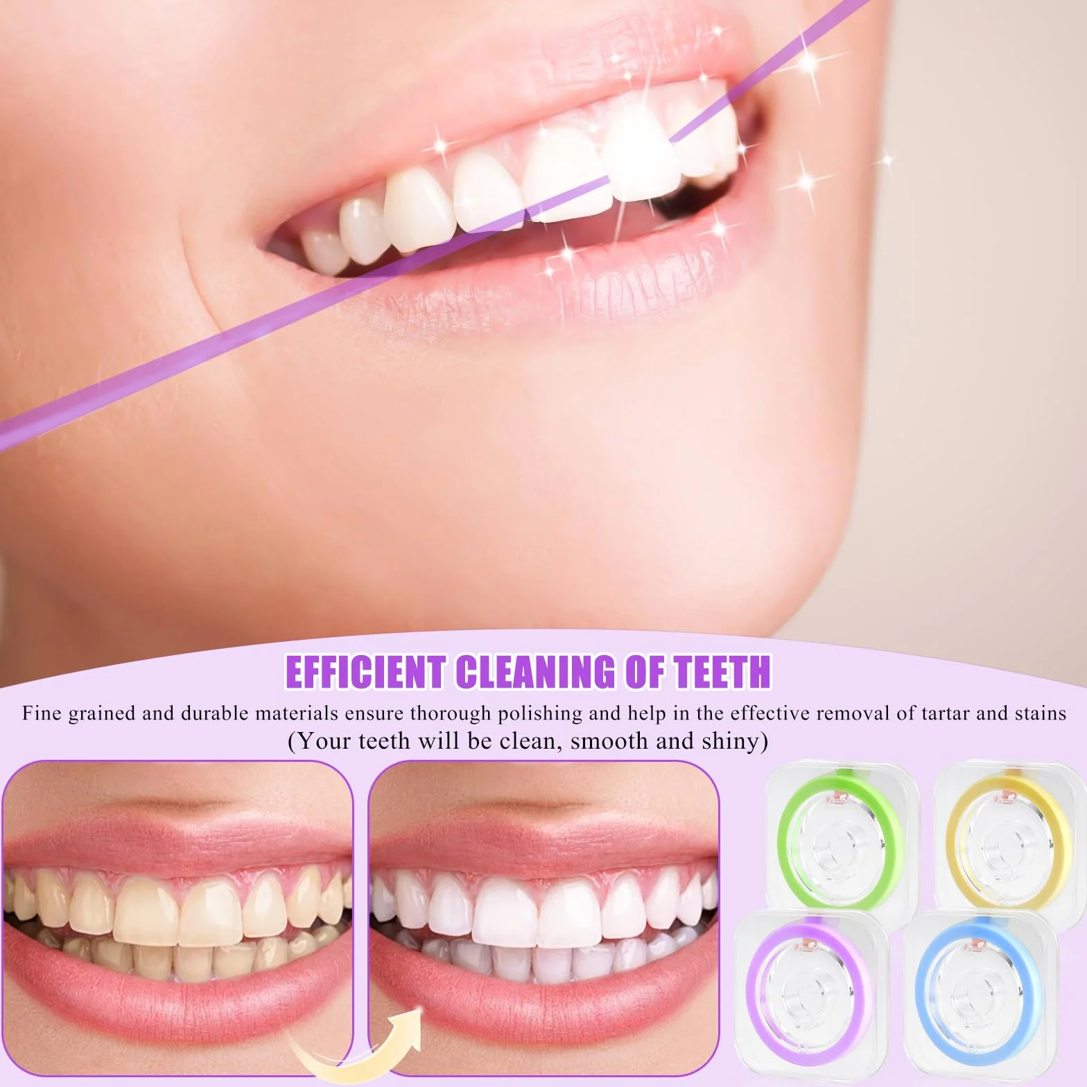 Carta Vetrata Dentale per Spazi Intermedi, Strisce Lucidatura, Pasta, Nastro 6m, 4 Volumi