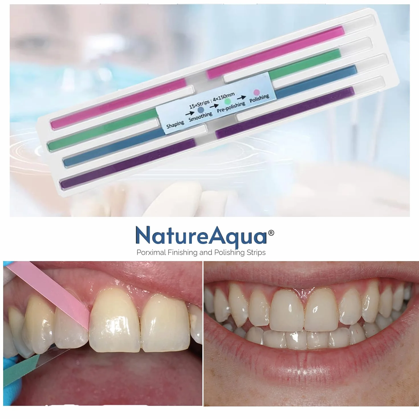 Carta vetrata dentale 4 mm lucidatura interdentale NatureAqua Resina 60 pz