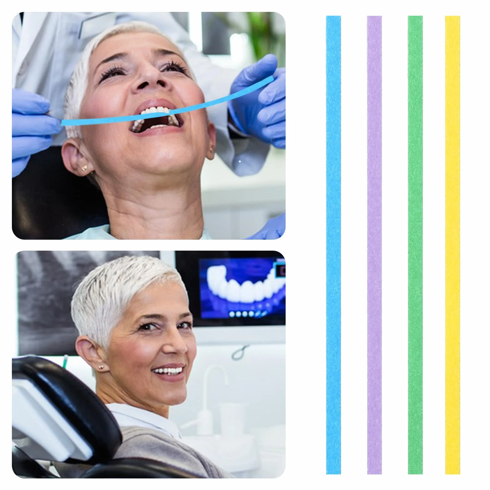 Lima dentale per denti scheggiati 60 pezzi strisce abrasive dentali smerigliatura levigatura pre-lucidatura